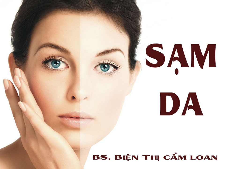 SẠM NÁM DA VÀ TẠI SAO SẠM NAM DA